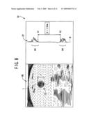 Apparatus for measuring inner diameter of tubular body of living being diagram and image