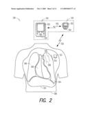 USING ACOUSTIC ENERGY TO COMPUTE A LUNG EDEMA FLUID STATUS INDICATION diagram and image