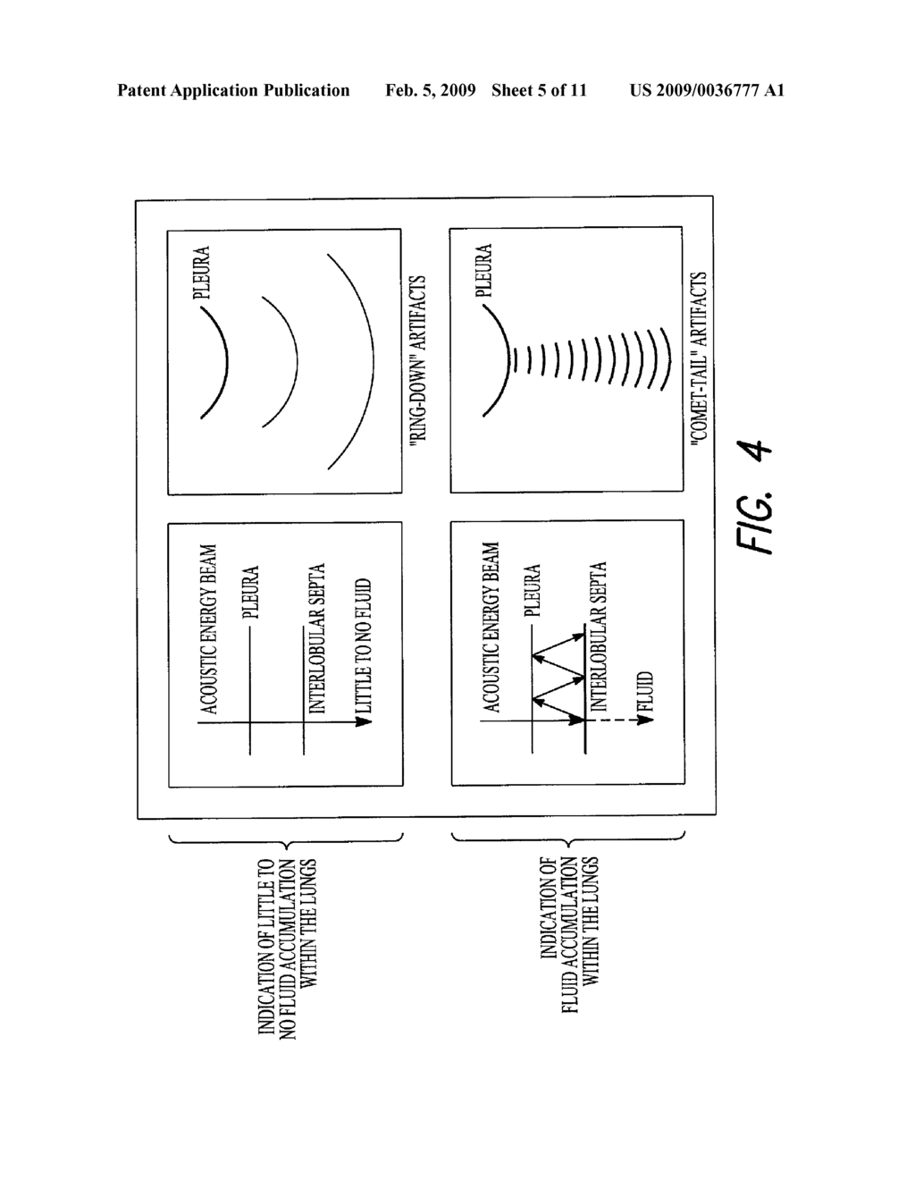 USING ACOUSTIC ENERGY TO COMPUTE A LUNG EDEMA FLUID STATUS INDICATION - diagram, schematic, and image 06