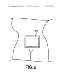 Wired and Wireless Remotely Controlled Ultrasonic Transducer and Imaging Apparatus diagram and image