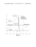 SYSTEMS AND METHODS FOR DETECTION OF VT AND VF FROM REMOTE SENSING ELECTRODES diagram and image