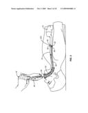 CLEANING DEVICE AND METHODS diagram and image