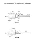 CLEANING DEVICE AND METHODS diagram and image