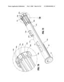 Anastomosis Instrument and Method for Performing Same diagram and image