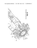 Anastomosis Instrument and Method for Performing Same diagram and image