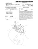 Method and Apparatus for the Containment of a Surgical Site diagram and image