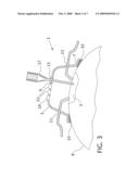 Method and Apparatus for the Containment of a Surgical Site diagram and image