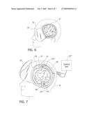 Method and Apparatus for the Containment of a Surgical Site diagram and image