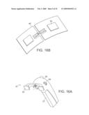 SYSTEMS AND METHODS FOR CLOSING A TISSUE OPENING diagram and image