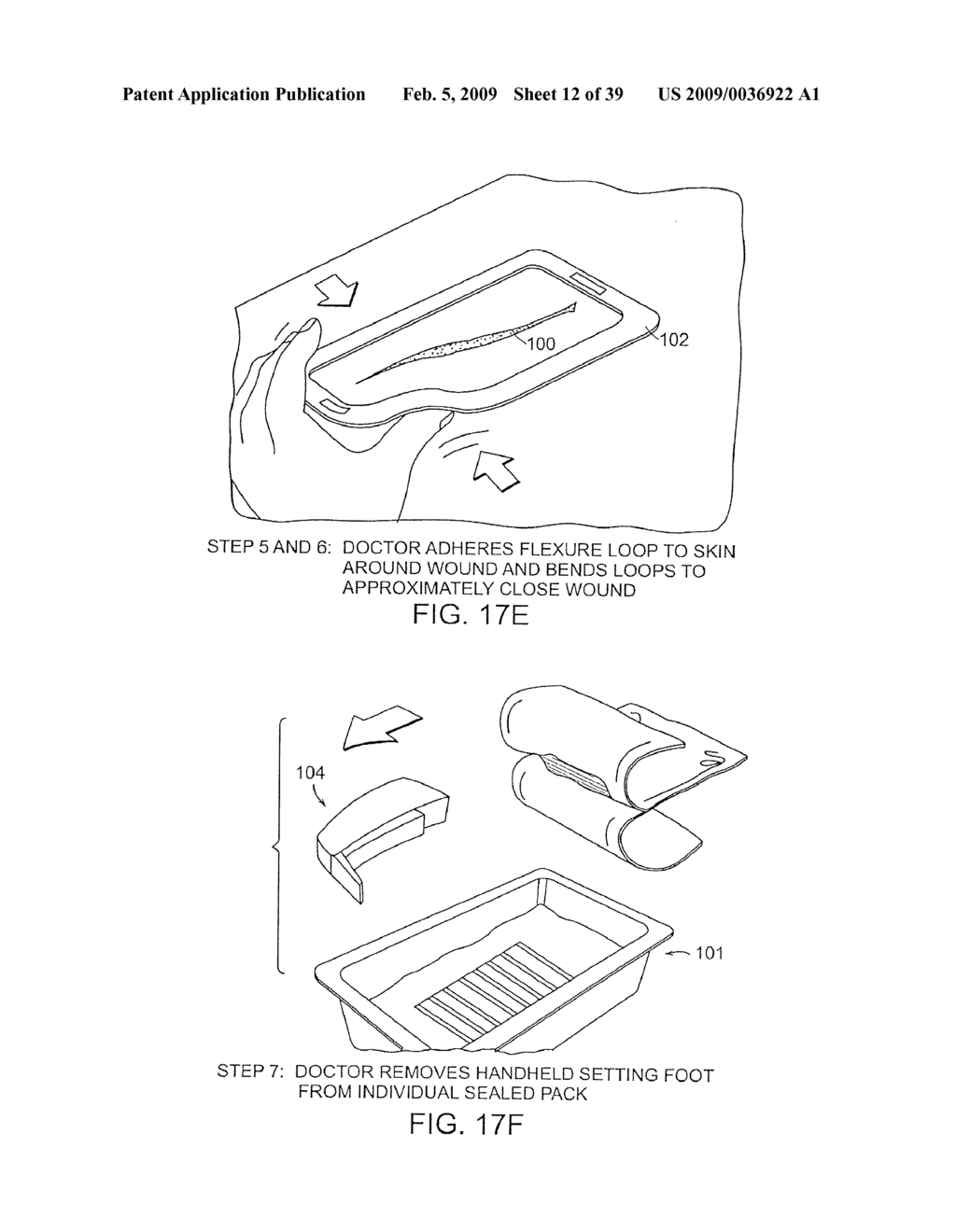 SYSTEMS AND METHODS FOR CLOSING A TISSUE OPENING - diagram, schematic, and image 13