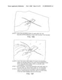 SYSTEMS AND METHODS FOR CLOSING A TISSUE OPENING diagram and image