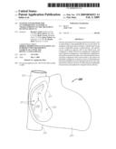 Systems and methods for accommodating anatomical characteristics in the treatment of septal defects diagram and image