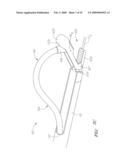 Systems and methods for accommodating anatomical characteristics in the treatment of septal defects diagram and image