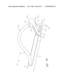 Systems and methods for accommodating anatomical characteristics in the treatment of septal defects diagram and image