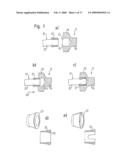 INTERVERTEBRAL STABILIZATION SYSTEM diagram and image