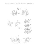 INTERVERTEBRAL STABILIZATION SYSTEM diagram and image