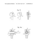 INTERVERTEBRAL STABILIZATION SYSTEM diagram and image