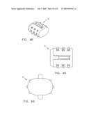 Method and apparatus for spinal facet fusion diagram and image