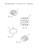 Method and apparatus for spinal facet fusion diagram and image