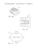 Method and apparatus for spinal facet fusion diagram and image