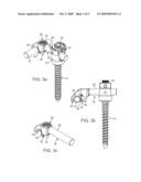 Offset connector for a spinal stabilization rod diagram and image