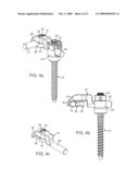 Offset connector for a spinal stabilization rod diagram and image