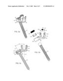 Offset connector for a spinal stabilization rod diagram and image