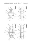 Bone fixing device diagram and image