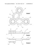 Bone fixing device diagram and image