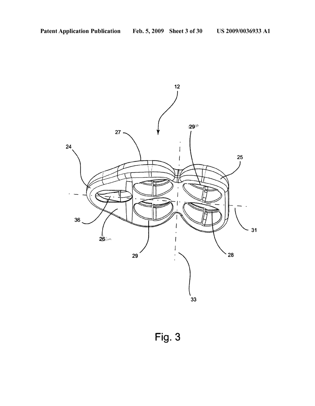 System and method for vertebral body plating - diagram, schematic, and image 04