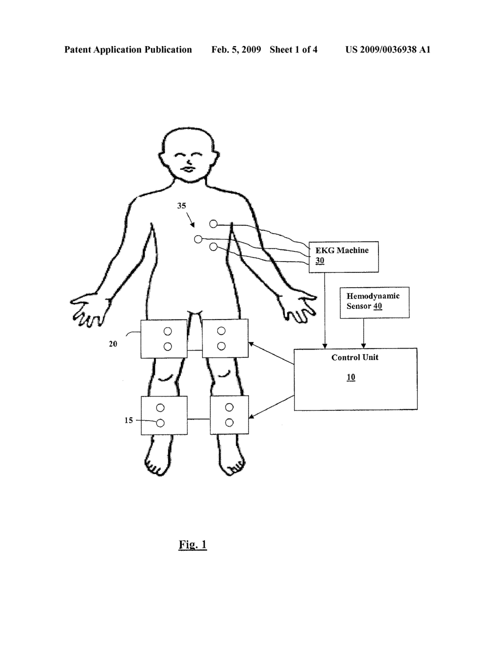 METHOD AND SYSTEM FOR EXTERNAL COUNTERPULSATION THERAPY - diagram, schematic, and image 02