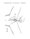 PELVIC DISORDER TREATMENTS diagram and image