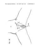 PELVIC DISORDER TREATMENTS diagram and image