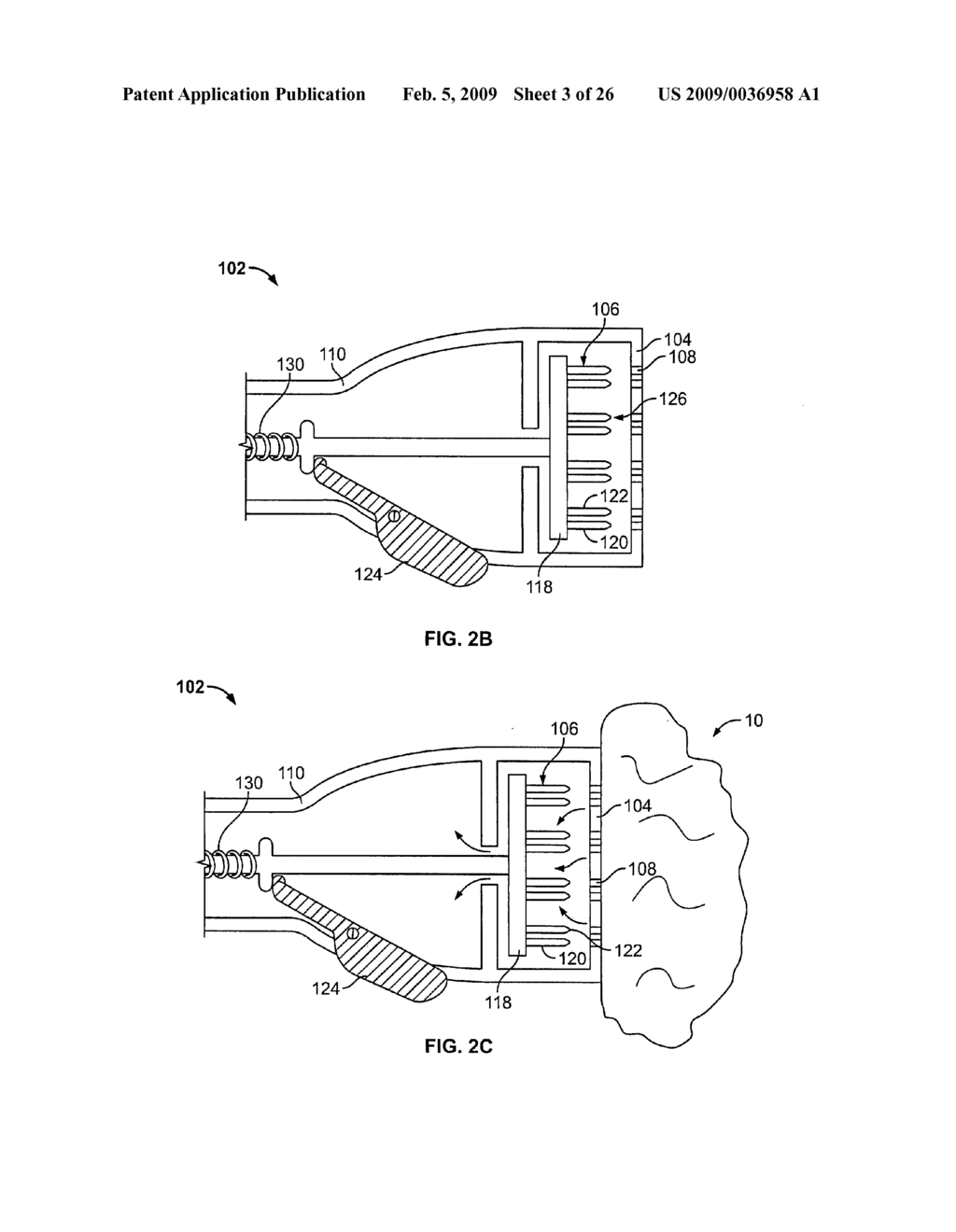 METHODS AND DEVICES FOR TREATING TISSUE - diagram, schematic, and image 04