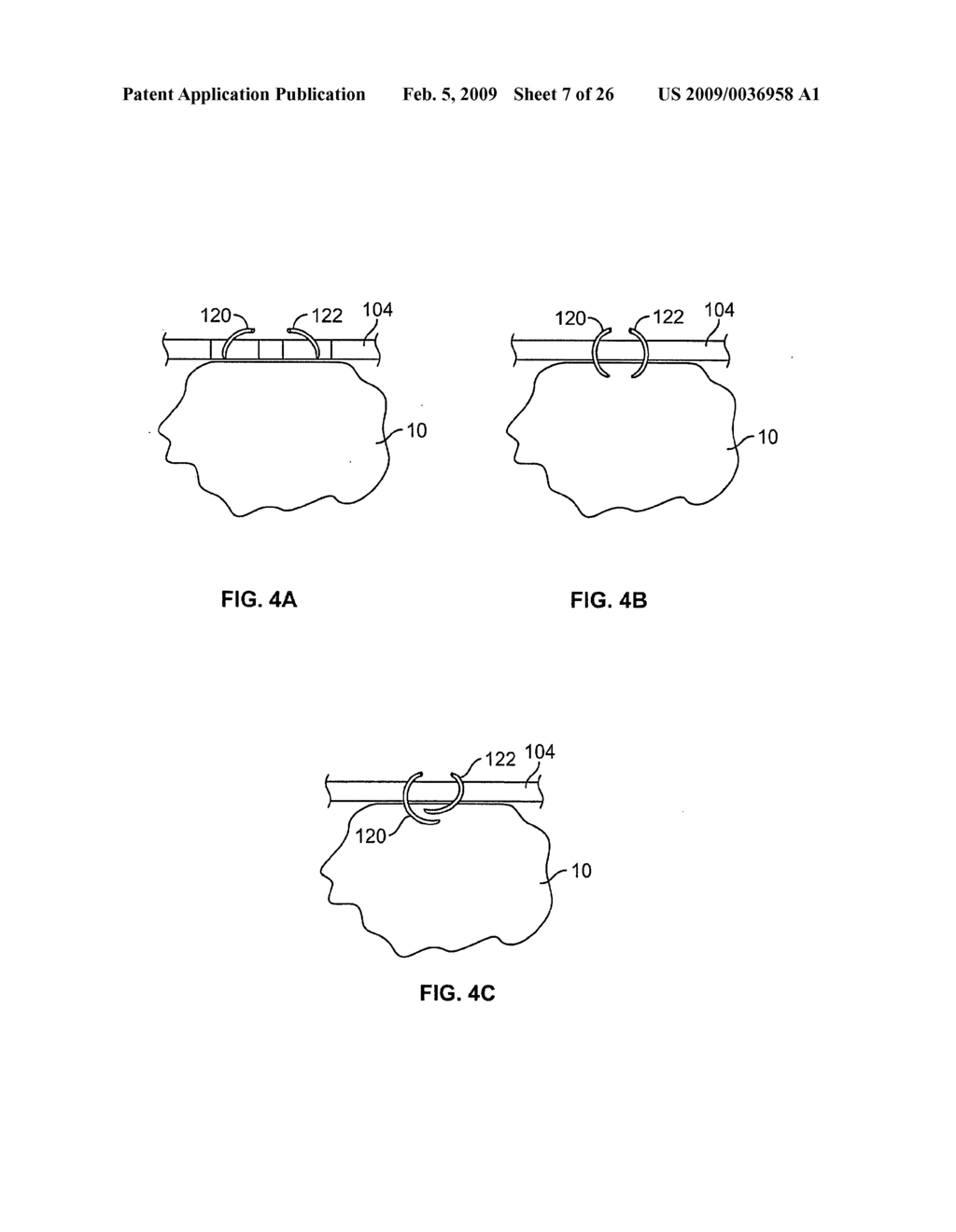 METHODS AND DEVICES FOR TREATING TISSUE - diagram, schematic, and image 08