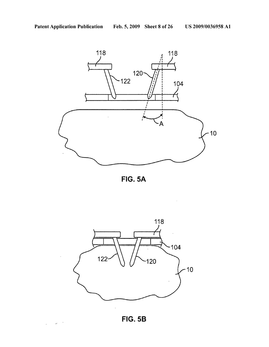 METHODS AND DEVICES FOR TREATING TISSUE - diagram, schematic, and image 09