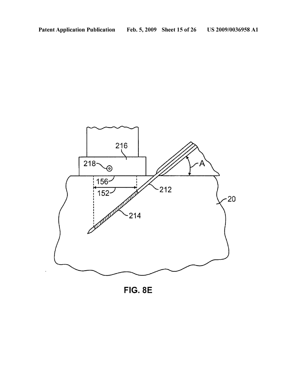 METHODS AND DEVICES FOR TREATING TISSUE - diagram, schematic, and image 16