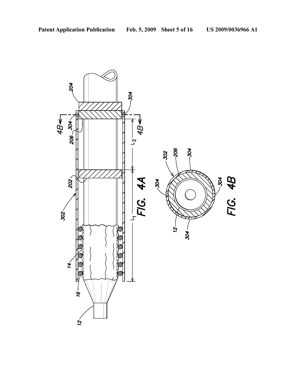 Device Delivery System With Two Stage Withdrawal - diagram, schematic, and image 06