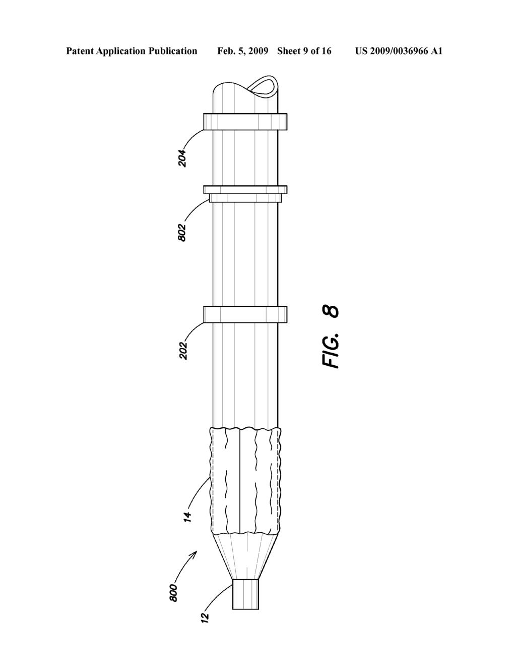 Device Delivery System With Two Stage Withdrawal - diagram, schematic, and image 10