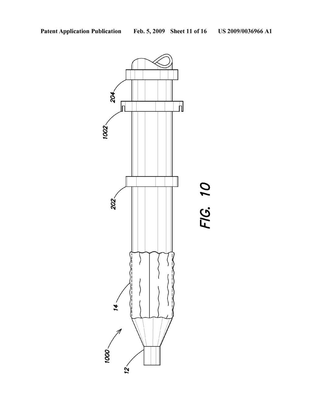 Device Delivery System With Two Stage Withdrawal - diagram, schematic, and image 12