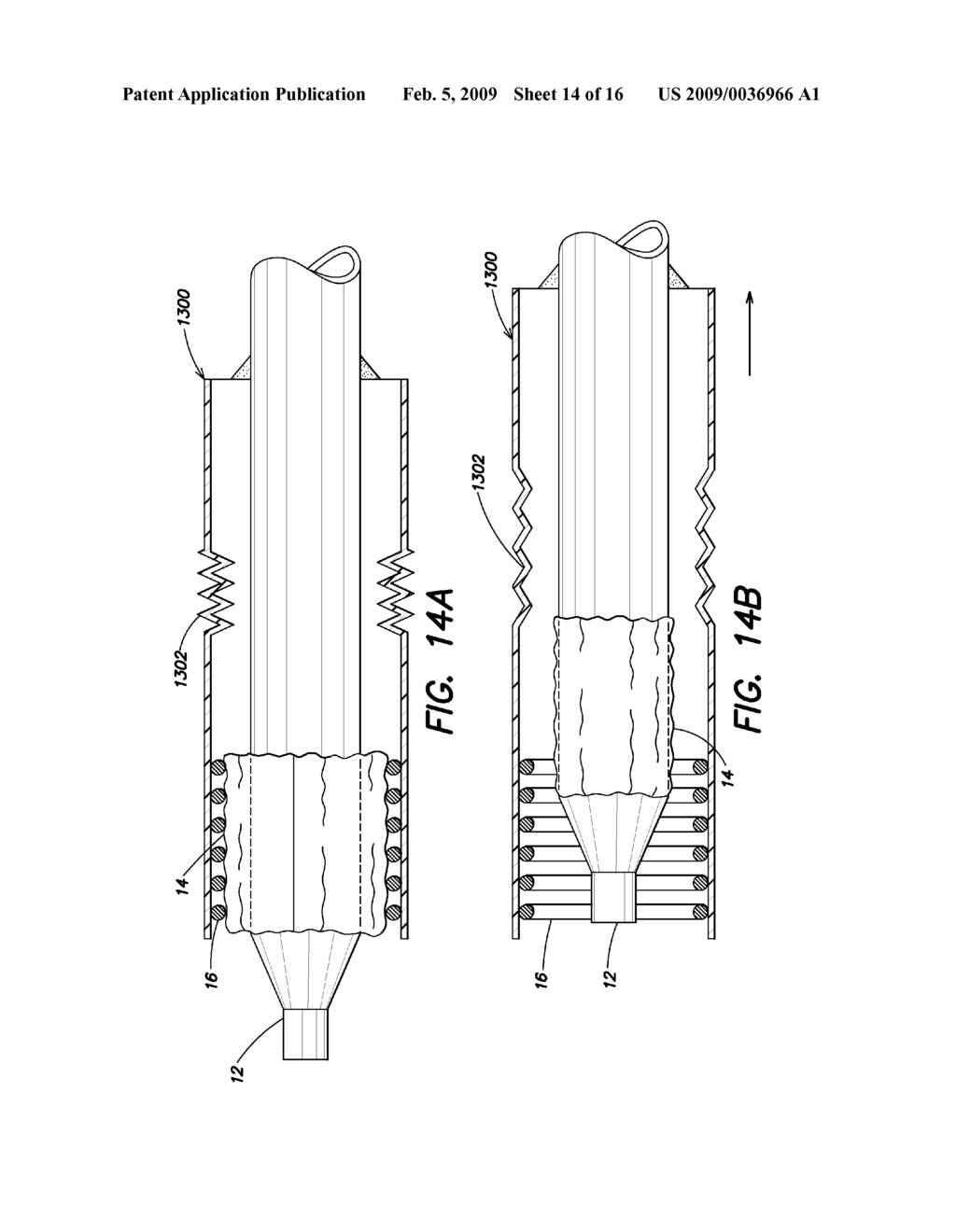 Device Delivery System With Two Stage Withdrawal - diagram, schematic, and image 15