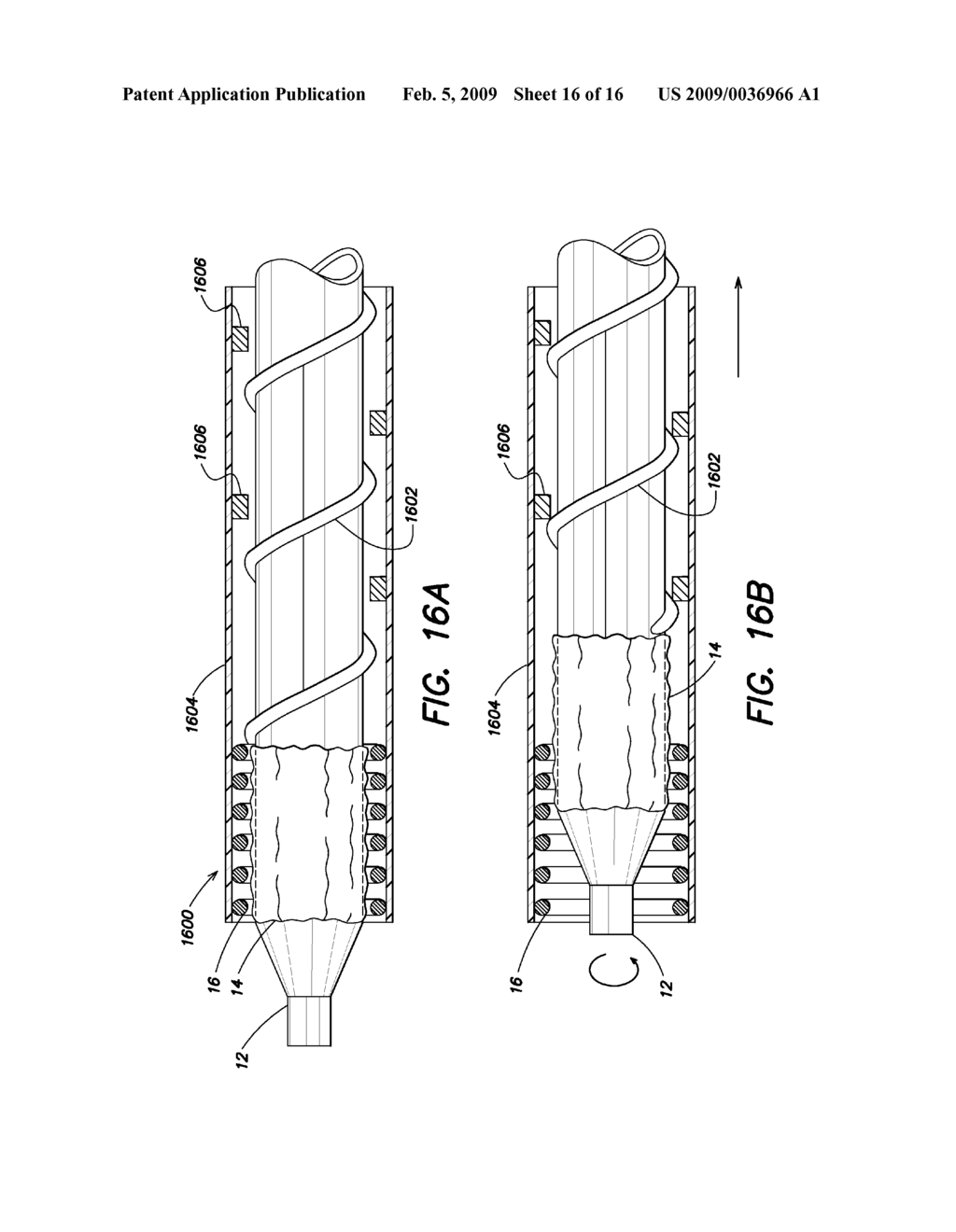 Device Delivery System With Two Stage Withdrawal - diagram, schematic, and image 17