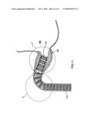 EXPANDABLE STENT AND METHOD FOR DELIVERY OF SAME diagram and image