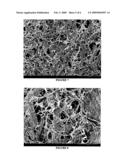 Bioresorbable implant diagram and image