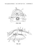 INDUCTIVE POWER TRANSFER SYSTEM FOR PALATAL IMPLANT diagram and image