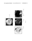 RAMAN DIFFERENCE SPECTRA BASED DISEASE CLASSIFICATION diagram and image