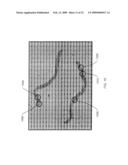 RAMAN DIFFERENCE SPECTRA BASED DISEASE CLASSIFICATION diagram and image