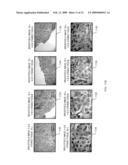 RAMAN DIFFERENCE SPECTRA BASED DISEASE CLASSIFICATION diagram and image