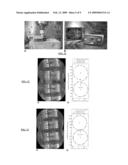 ROBUST MOSAICING METHOD. NOTABLY WITH CORRECTION OF MOTION DISTORTIONS AND TISSUE DEFORMATIONS FOR A VIVO FIBERED MICROSCOPY diagram and image