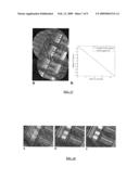 ROBUST MOSAICING METHOD. NOTABLY WITH CORRECTION OF MOTION DISTORTIONS AND TISSUE DEFORMATIONS FOR A VIVO FIBERED MICROSCOPY diagram and image